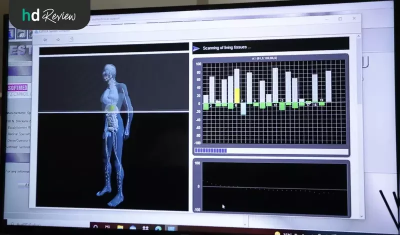 content review restoring male sexual with btl xwave at dr story clinic by sarun hanboonsat 5