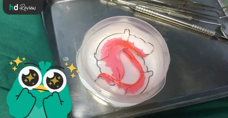 content review retainer wire at be bright dental clinic by jirarat sordsri 4