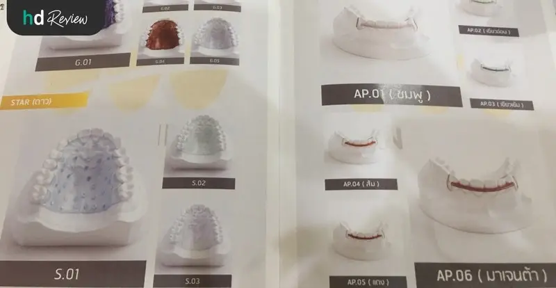 content review retainer wire at be bright dental clinic by jirarat sordsri 6