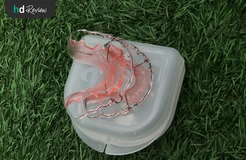 รีวิว ทำรีเทนเนอร์แบบลวด ที่ VP Dental Clinic