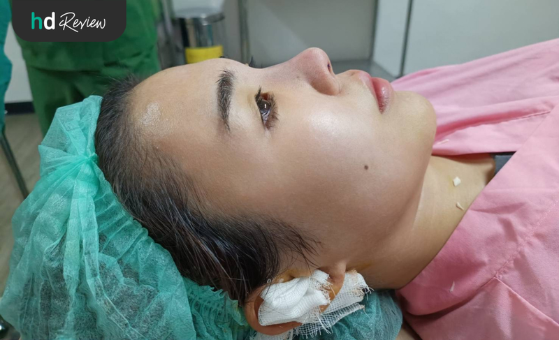 ขั้นตอนแก้จมูก เสริมจมูก ที่ The Cupid Clinic อุดมสุข