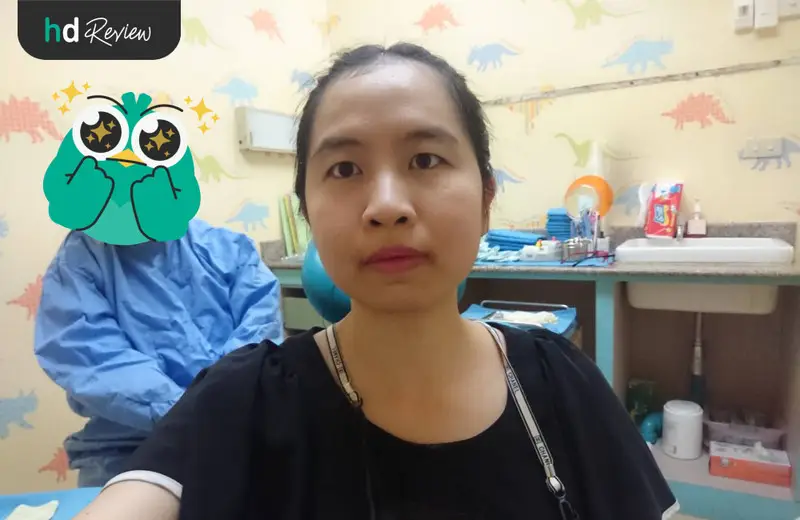 รีวิว ขูดหินปูนสิทธิประกันสังคม พร้อมเคลือบฟลูออไรด์ ที่ Dentist at Home Dental Clinic
