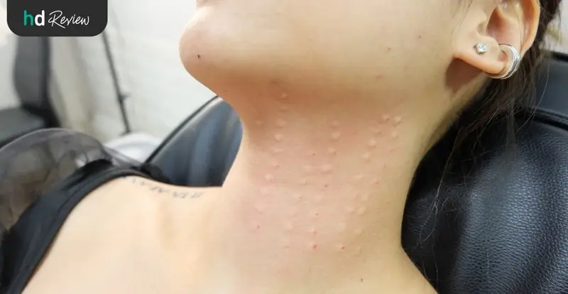 content review signature divine lift and meso pink line at divine clinic by sarinporn wattanaphand 10