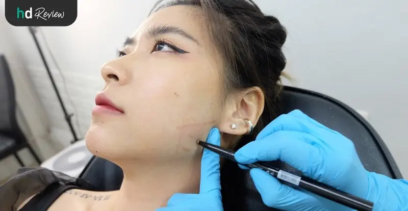 รีวิว Divine Lift ลิฟท์กรอบหน้า และเมโสหน้าใส Pink Line ที่ Divine Aesthetica Clinic