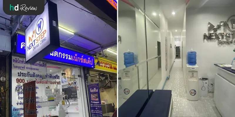 รีวิว ฟอกสีฟัน ด้วยระบบ Cool Light พร้อมขูดหินปูน ที่ NextStep Dental