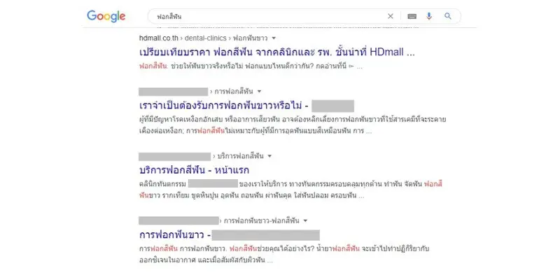 รีวิว ฟอกสีฟัน ด้วยระบบ Cool Light พร้อมขูดหินปูน ที่ NextStep Dental