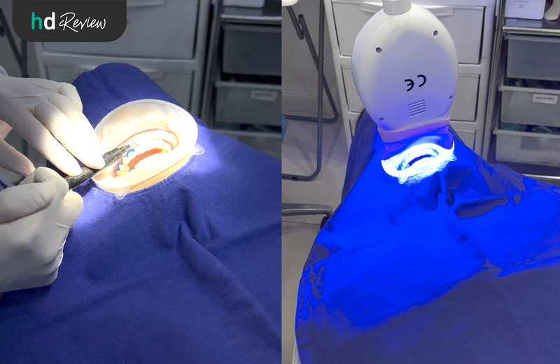 ขั้นตอนการฟอกสีฟันแบบ Cool light