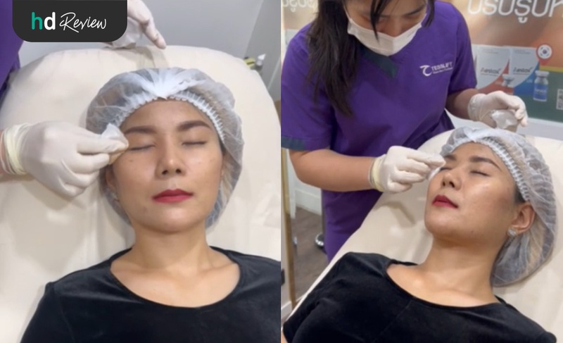 เช็ดผิวก่อนทำ Thermage Eyes ที่ Anjali Clinic