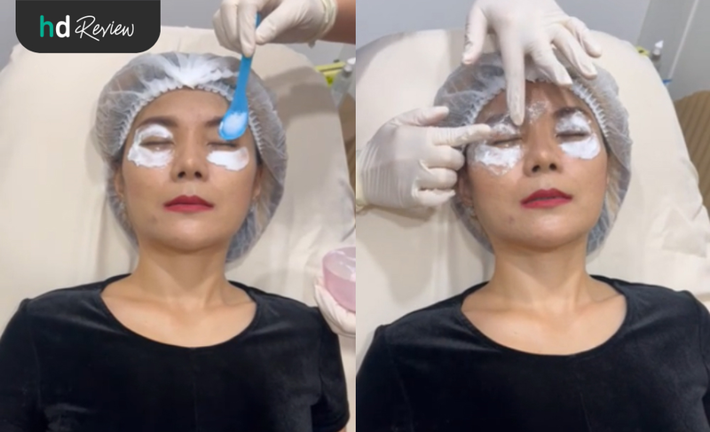 ทายาชาก่อนทำ Thermage Eyes ที่ Anjali Clinic