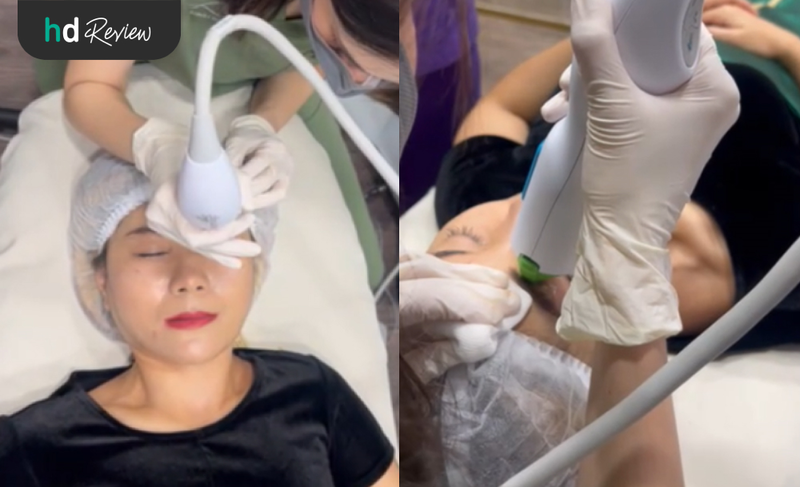 ขั้นตอนการทำ Thermage Eyes ที่ Anjali Clinic
