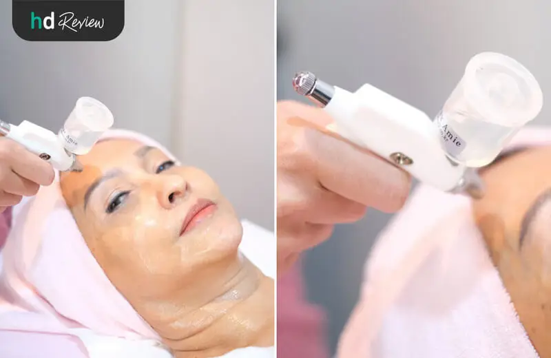 รีวิว ทำทรีตเมนต์ Advanced Beauty Rest ที่ อนิสสาคลินิก (Anissa Clinic)