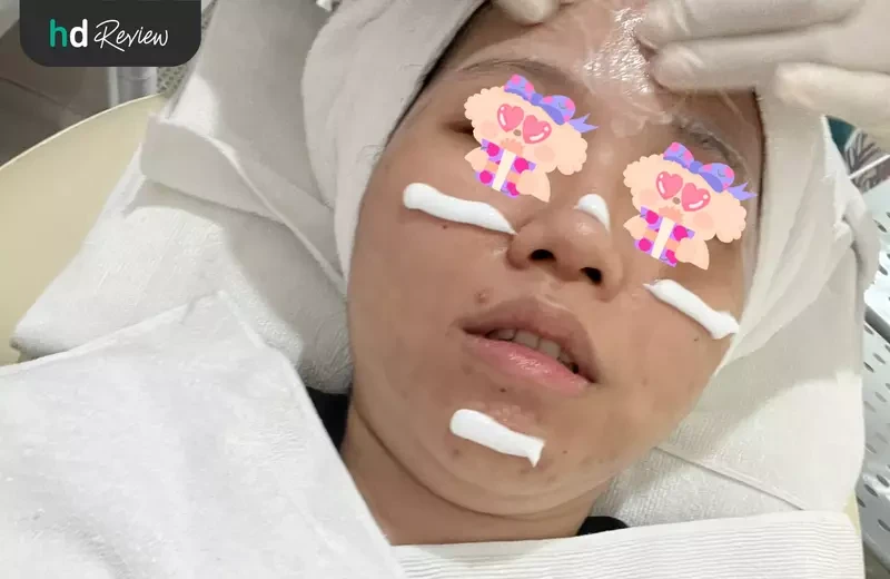 ขั้นตอนทำความสะอาดหน้า