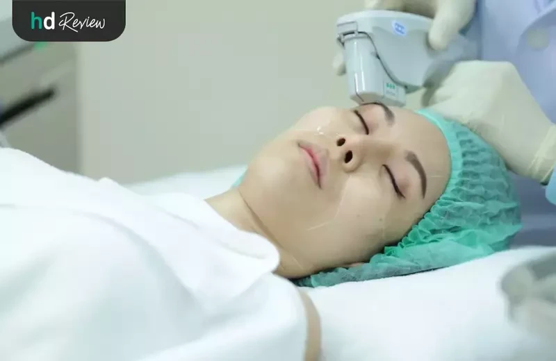 content review ulthera face at la grace clinic by watjanarat luangdilok 2