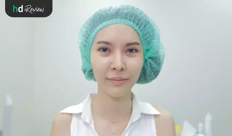 content review ulthera face at la grace clinic by watjanarat luangdilok 6