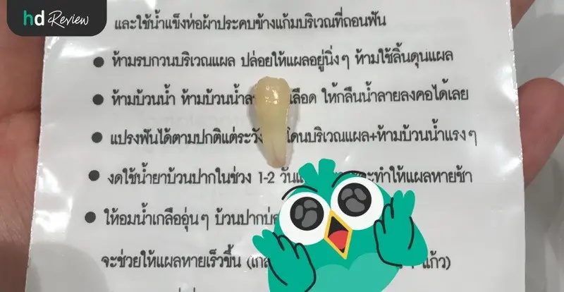 HDreview รีวิวผ่าฟันคุด