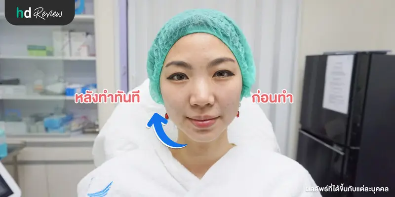 content review wow smash at wow clinic by ten 3