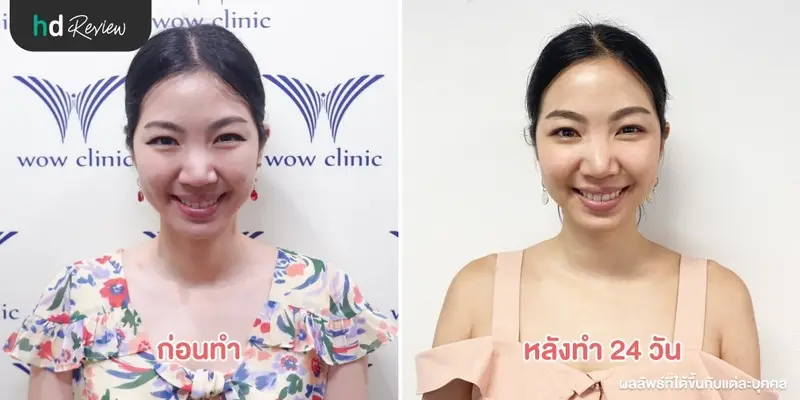 content review wow smash at wow clinic by ten 9