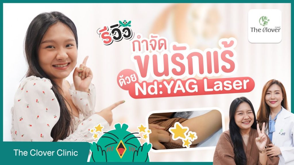 รีวิวกำจัดขนรักแร้ด้วย Long Pulse ND YAG ที่ The Clover Clinic
