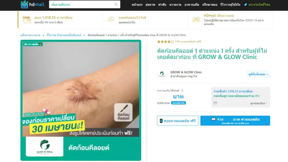 แพ็กเกจ ตัดก้อนคีลอยด์ ที่ GROW&GLOW Clinic