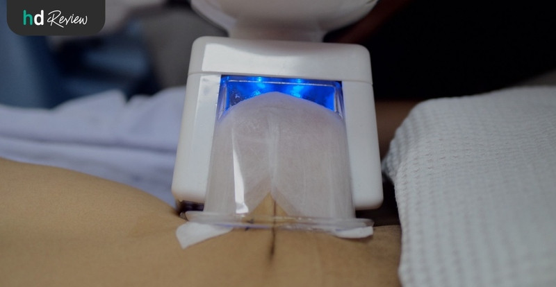 รีวิวสลายไขมันด้วยความเย็น Cool Slim ที่ Punnisa Clinic