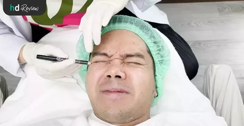 ภาพขั้นตอนการฉีดโบท็อกซ์ ที่ LV Aesthetic By Dr.Lucy