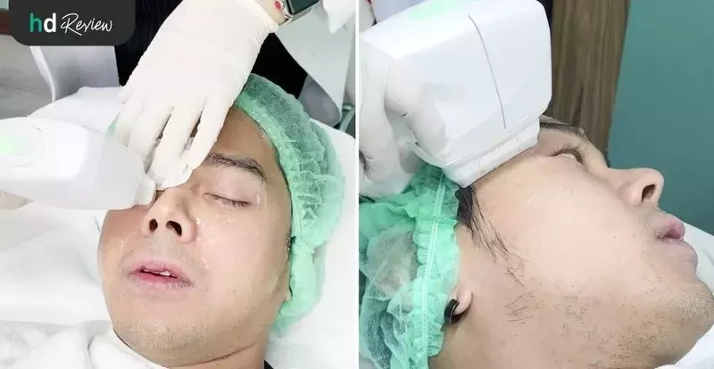 ขั้นตอนการทำ Hifu ที่ LV Aesthetic By Dr.Lucy