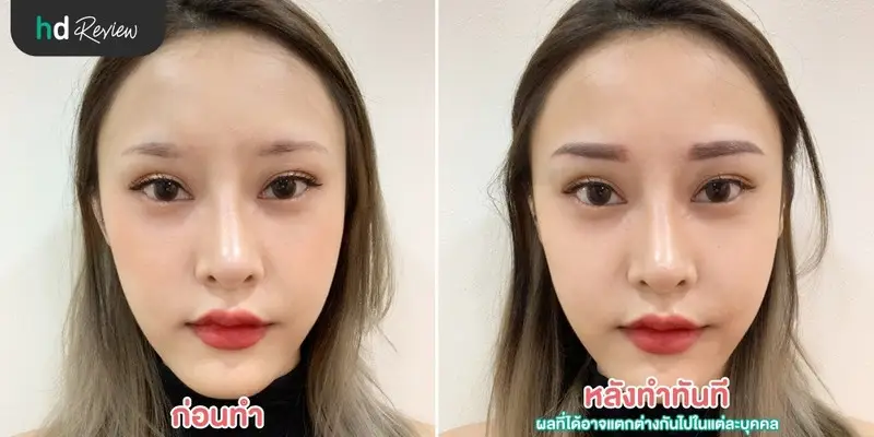 HDreview รีวิว สักคิ้ว 3 มิติ ที่ Baramee Beauty