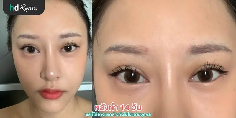 HDreview รีวิว สักคิ้ว 3 มิติ ที่ Baramee Beauty