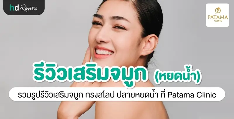 รีวิว เสริมจมูก ทรงสโลป ปลายหยดน้ำ ที่ Patama Clinic