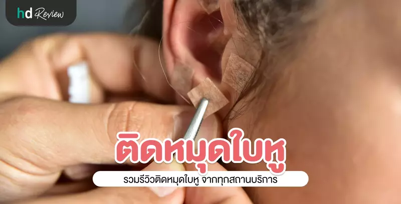 รวมรีวิวติดหมุดใบหู ติดเมล็ดผักกาดที่หู ประสบการณ์จริงจาก HDreview