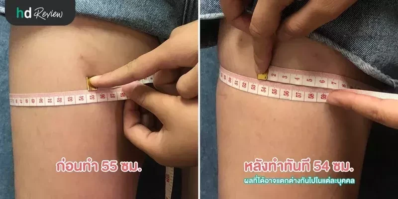 ผลลัพธ์ก่อนทำและหลังทำ