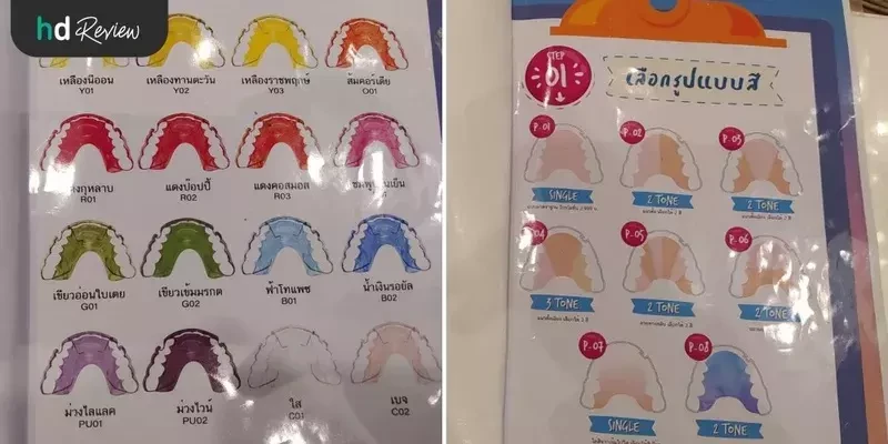 รีเทนเนอร์ แบบลวด ที่ Smile Seasons Dental Clinic