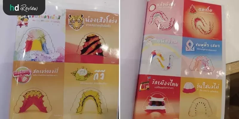 รีเทนเนอร์ แบบลวด ที่ Smile Seasons Dental Clinic