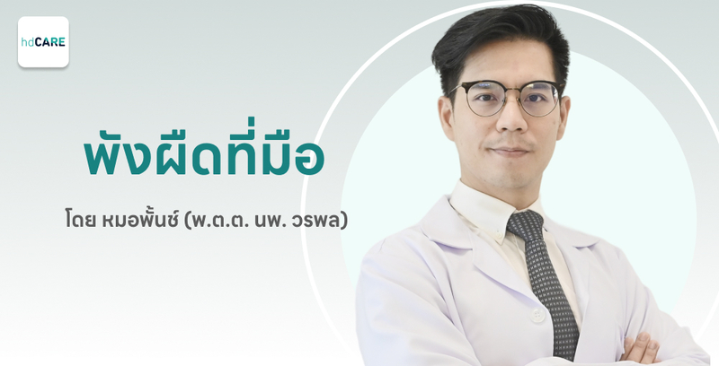ผ่าตัดพังผืดที่มือ กับ พ.ต.ต. นพ. วรพล เจริญพร ด้วยบริการจาก HDcare