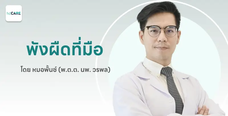 ผ่าตัดพังผืดที่มือ กับ พ.ต.ต. นพ. วรพล เจริญพร ด้วยบริการจาก HDcare