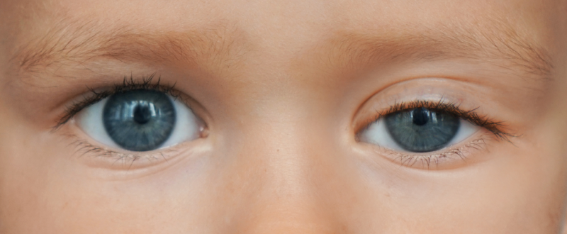 ใครไม่เหมาะกับการทำ Celeb Eyes?