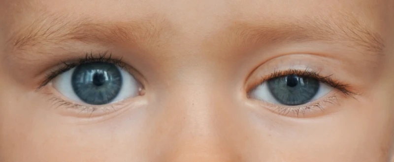 ใครไม่เหมาะกับการทำ Celeb Eyes?