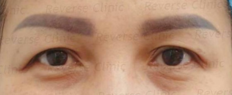 ใครเหมาะกับการทำ Celeb Eyes บ้าง?