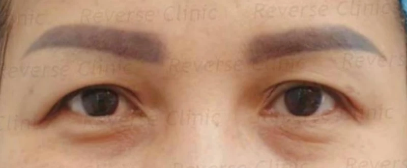 ใครเหมาะกับการทำ Celeb Eyes บ้าง?