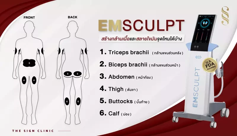 สามารถสร้างกล้ามเนื้อด้วยเครื่อง Emsculpt ที่บริเวณใดได้บ้าง?