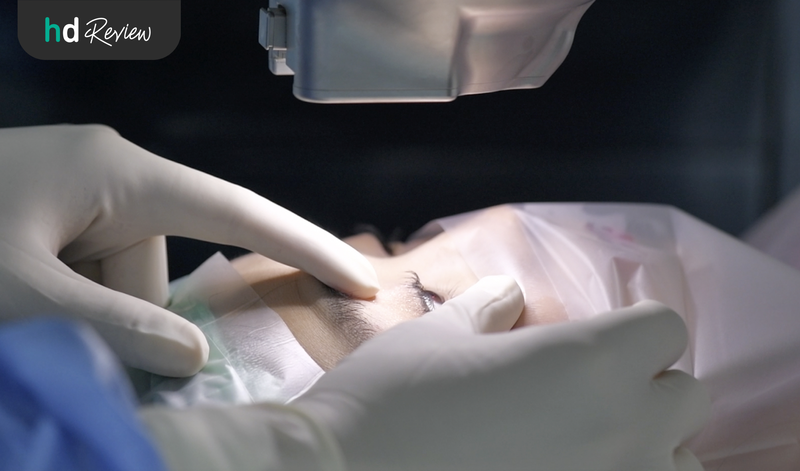 ขั้นตอนการทำเลสิกไร้ใบมีด Femto LASIK
