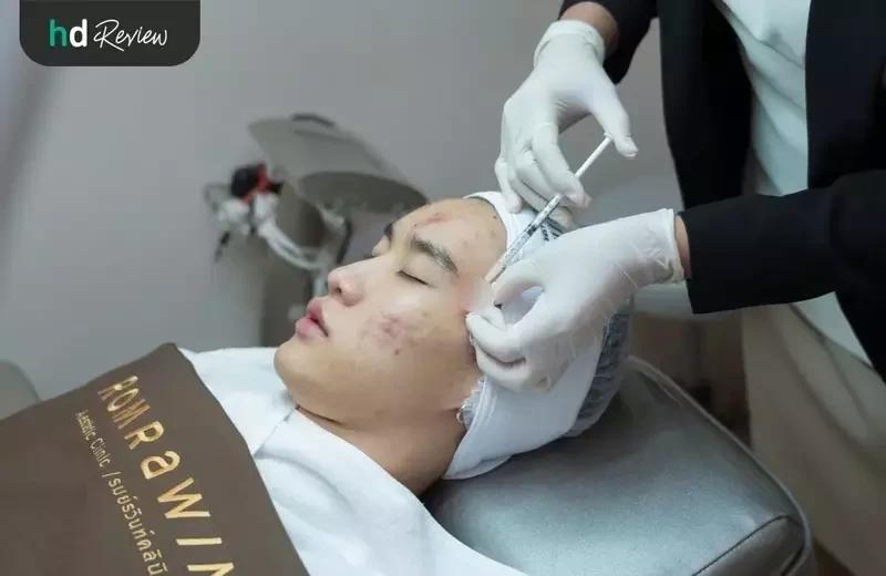 ขั้นตอนการ รักษาสิว โปรแกรม AC Clear III ที่ Romrawin Clinic