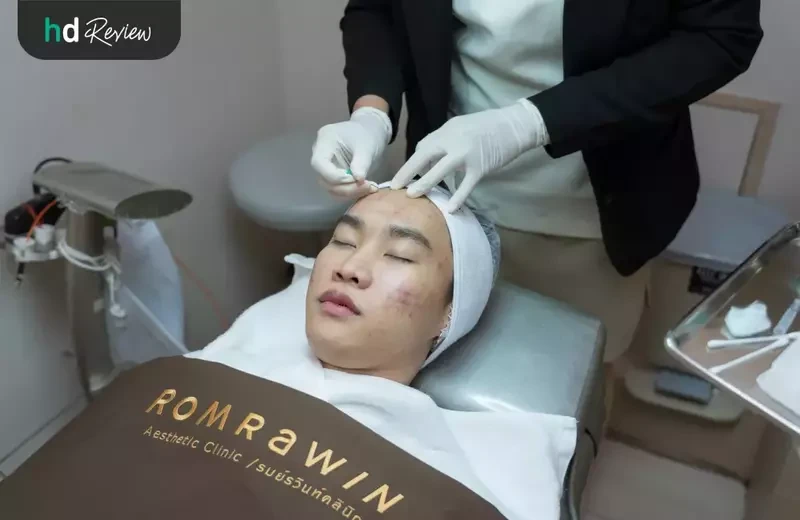 ขั้นตอนการ รักษาสิว โปรแกรม AC Clear III ที่ Romrawin Clinic