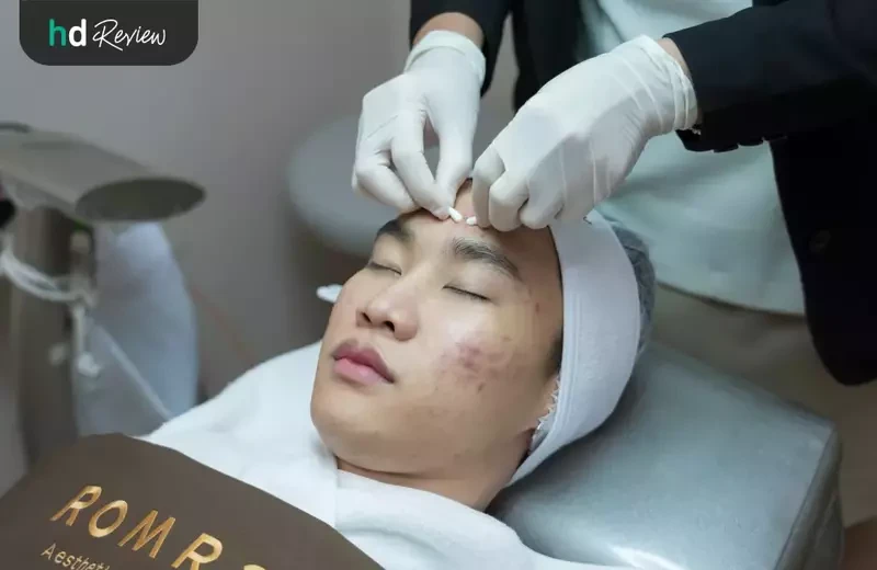 ขั้นตอนการ รักษาสิว โปรแกรม AC Clear III ที่ Romrawin Clinic