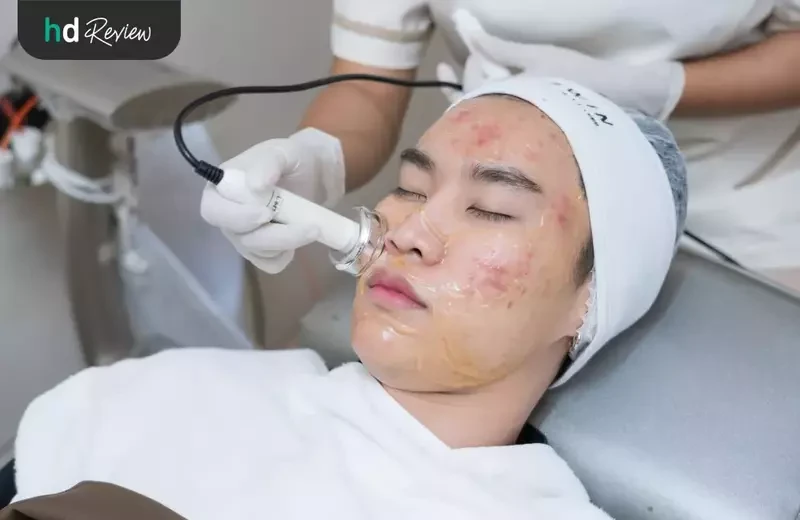 ขั้นตอนการ รักษาสิว โปรแกรม AC Clear III ที่ Romrawin Clinic