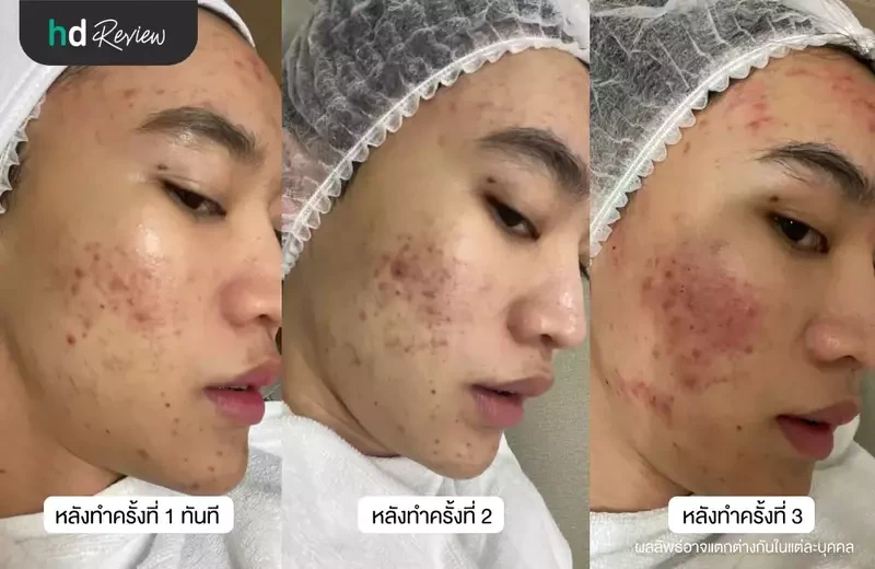 ผลลัพธ์หลังใช้บริการ 3 ครั้ง