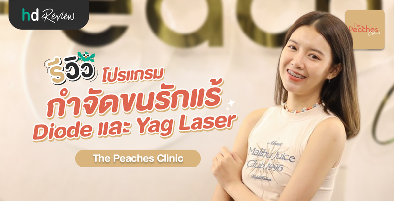 รีวิวเลเซอร์กำจัดขนรักแร้ เปรียบเทียบโปรแกรม Diode และ Nd:YAG ที่ The Peaches Clinic