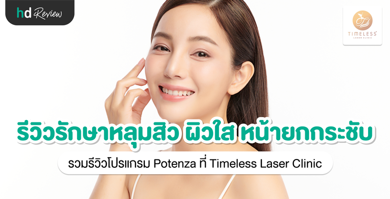 รีวิวรักษาหลุมสิว ผิวใส หน้ายกกระชับ ด้วยโปรแกรม Potenza ที่ Timeless Laser Clinic