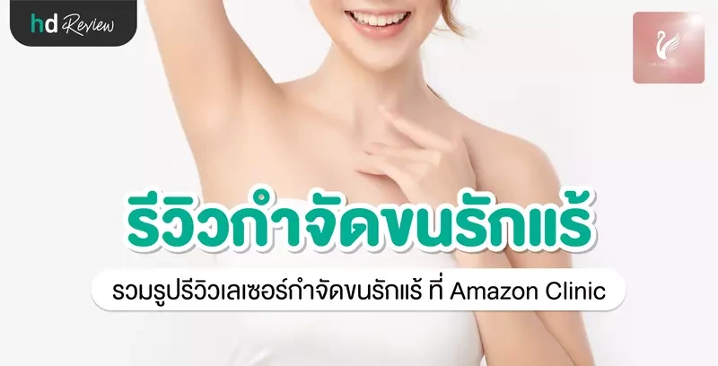 รีวิว เลเซอร์กำจัดขนรักแร้ ที่ Amazon Clinic