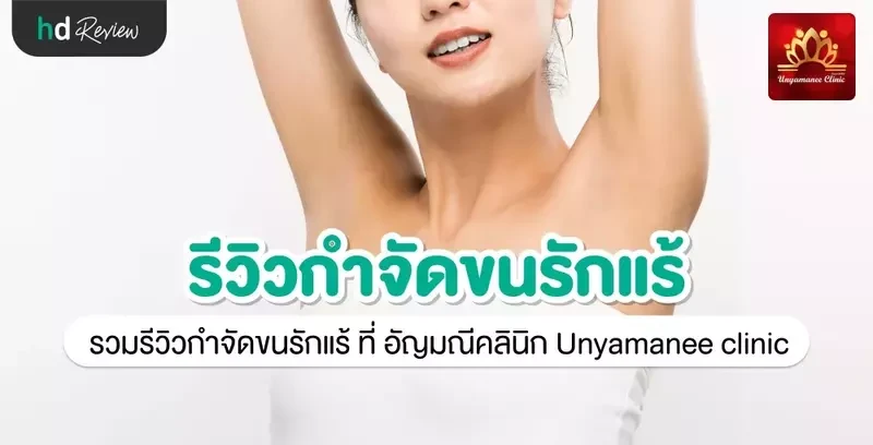 รีวิว กำจัดขนรักแร้ ที่ อัญมณีคลินิก Unyamanee clinic
